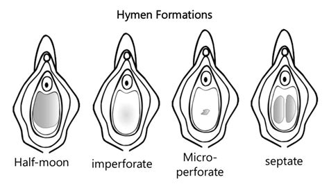 virgin pussy vs non virgin pussy|Female anatomy: Vulva, vagina, and breasts explained — Flo